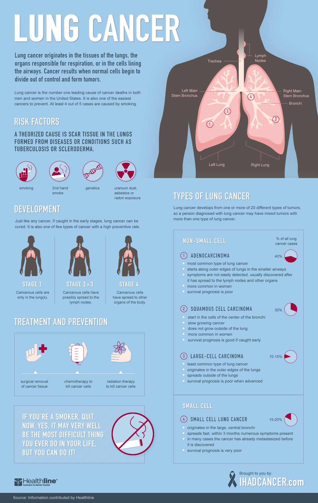 Lung Cancer: A Visual Guide