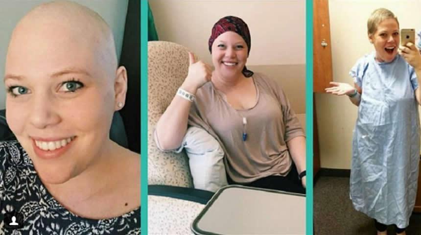 The Top Pros And Cons Of Losing Your Hair From Chemo 
