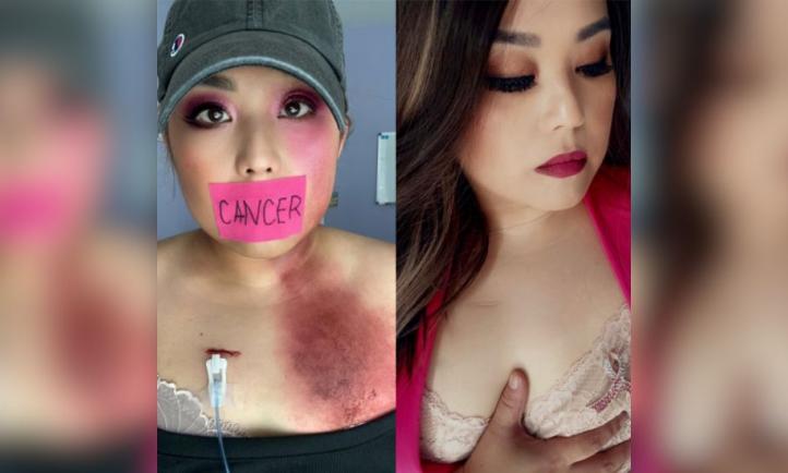 Meet Ria Despi: Skin Cancer & Breast Cancer Survivor